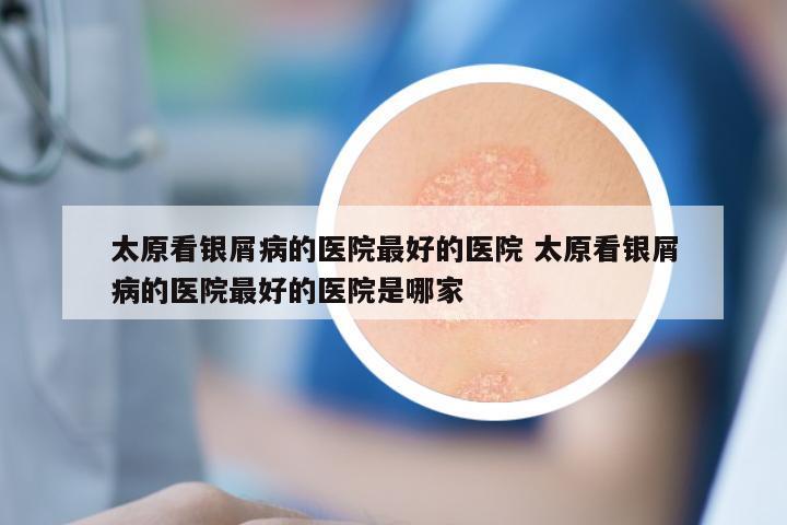 太原看银屑病的医院最好的医院 太原看银屑病的医院最好的医院是哪家