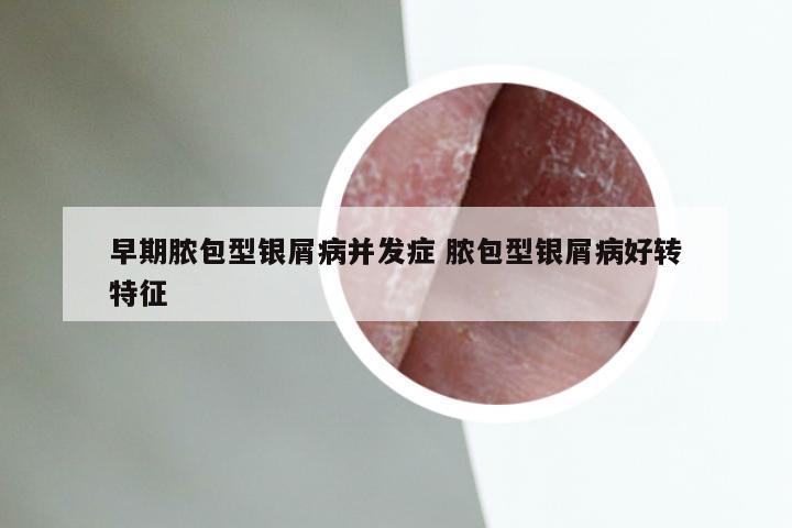 早期脓包型银屑病并发症 脓包型银屑病好转特征