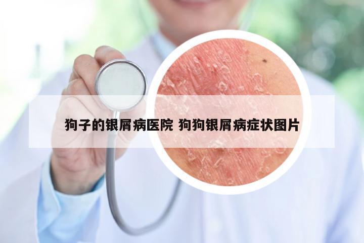 狗子的银屑病医院 狗狗银屑病症状图片
