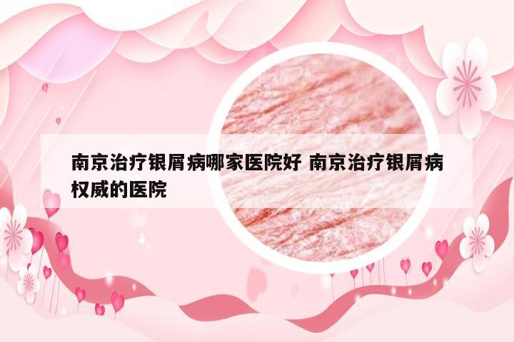 南京治疗银屑病哪家医院好 南京治疗银屑病权威的医院