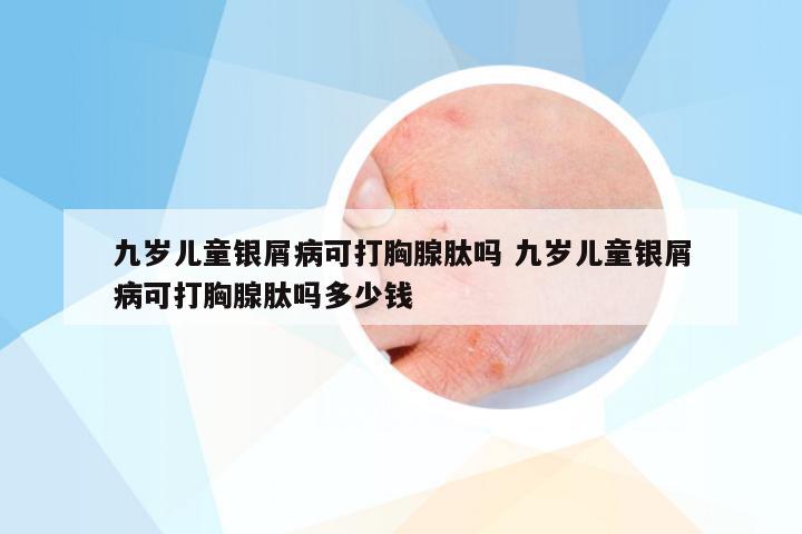 九岁儿童银屑病可打胸腺肽吗 九岁儿童银屑病可打胸腺肽吗多少钱
