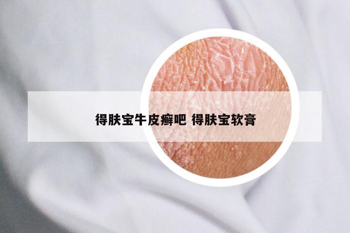得肤宝牛皮癣吧 得肤宝软膏