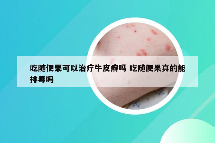 吃随便果可以治疗牛皮癣吗 吃随便果真的能排毒吗