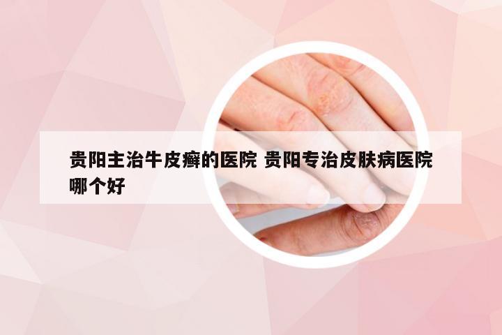 贵阳主治牛皮癣的医院 贵阳专治皮肤病医院哪个好