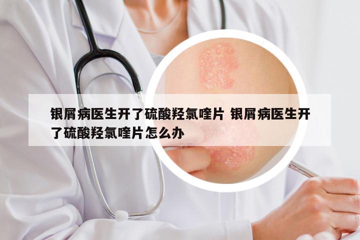银屑病医生开了硫酸羟氯喹片 银屑病医生开了硫酸羟氯喹片怎么办