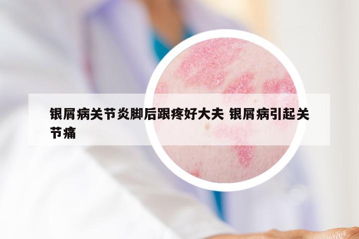 银屑病关节炎脚后跟疼好大夫 银屑病引起关节痛