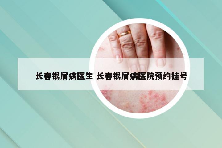 长春银屑病医生 长春银屑病医院预约挂号