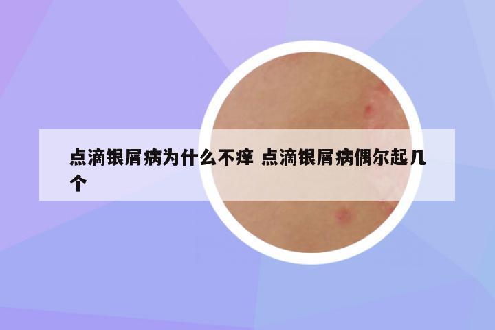 点滴银屑病为什么不痒 点滴银屑病偶尔起几个