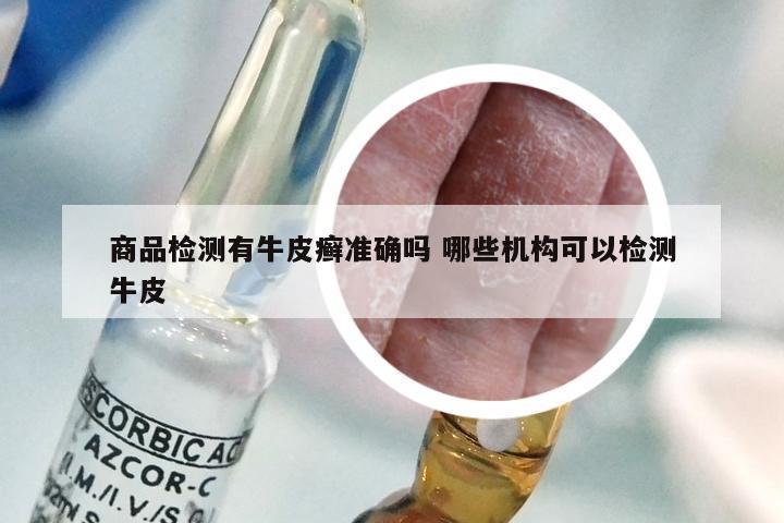 商品检测有牛皮癣准确吗 哪些机构可以检测牛皮