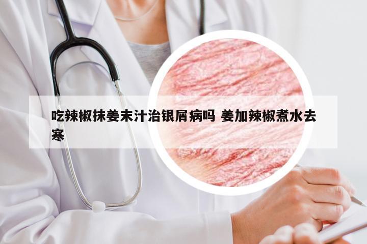 吃辣椒抹姜末汁治银屑病吗 姜加辣椒煮水去寒