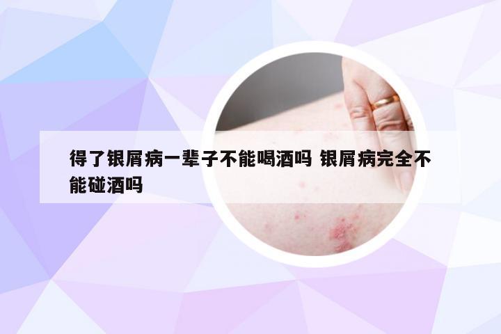 得了银屑病一辈子不能喝酒吗 银屑病完全不能碰酒吗