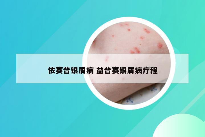 依赛普银屑病 益普赛银屑病疗程