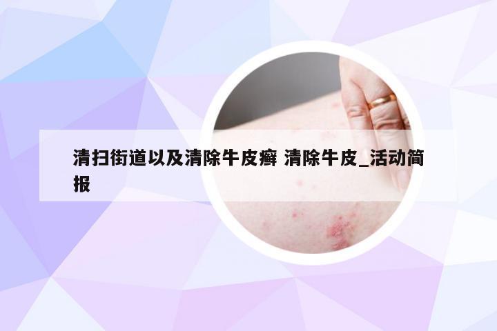 清扫街道以及清除牛皮癣 清除牛皮_活动简报