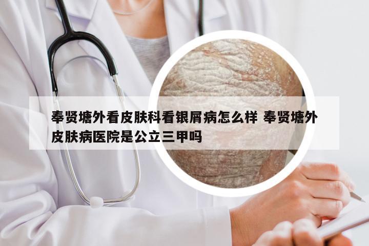 奉贤塘外看皮肤科看银屑病怎么样 奉贤塘外皮肤病医院是公立三甲吗