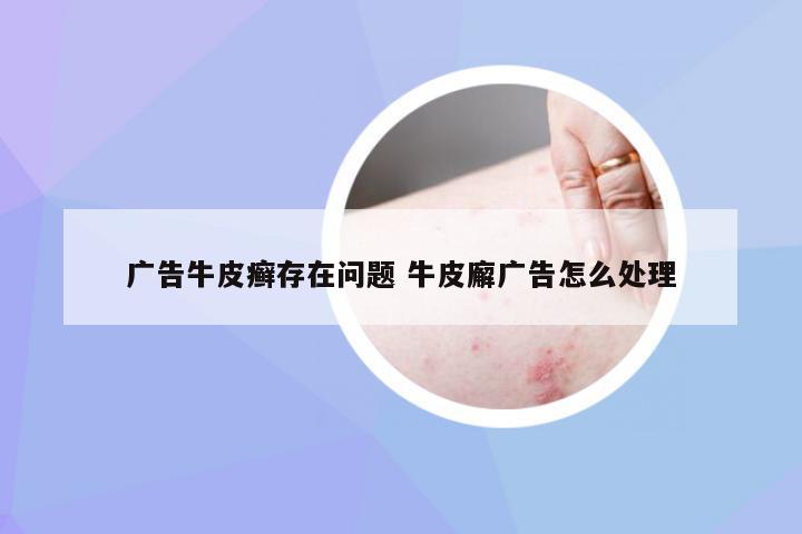 广告牛皮癣存在问题 牛皮廨广告怎么处理