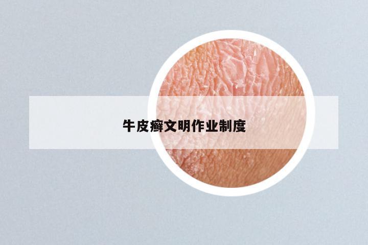 牛皮癣文明作业制度