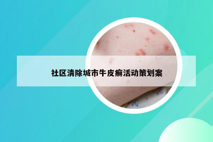 社区清除城市牛皮癣活动策划案