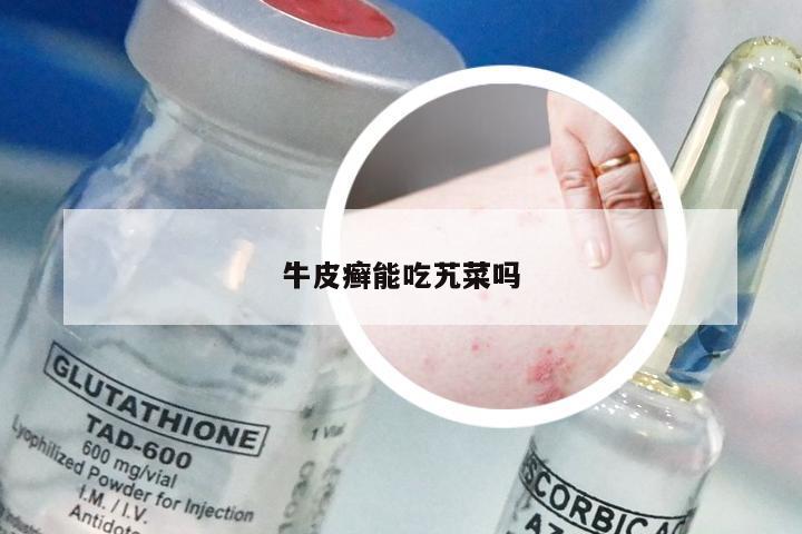 牛皮癣能吃艽菜吗