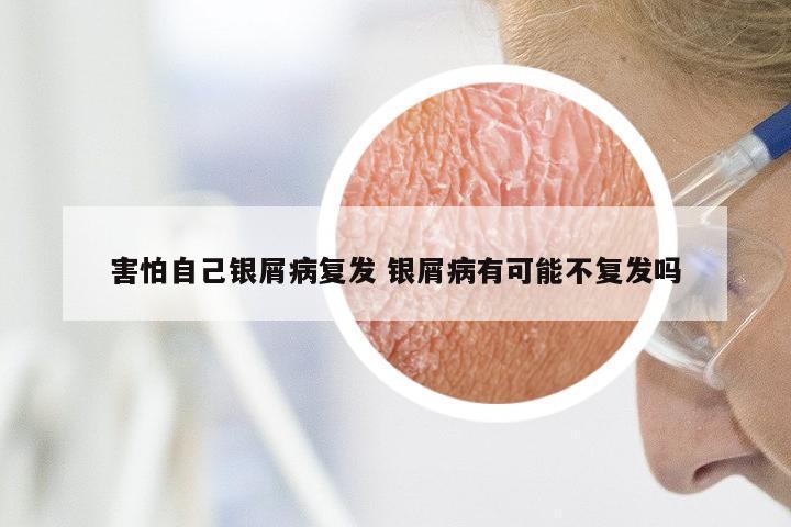 害怕自己银屑病复发 银屑病有可能不复发吗