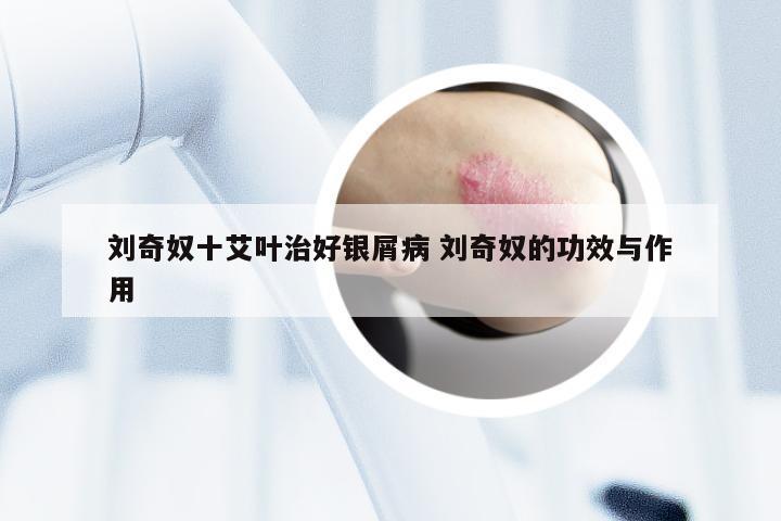 刘奇奴十艾叶治好银屑病 刘奇奴的功效与作用