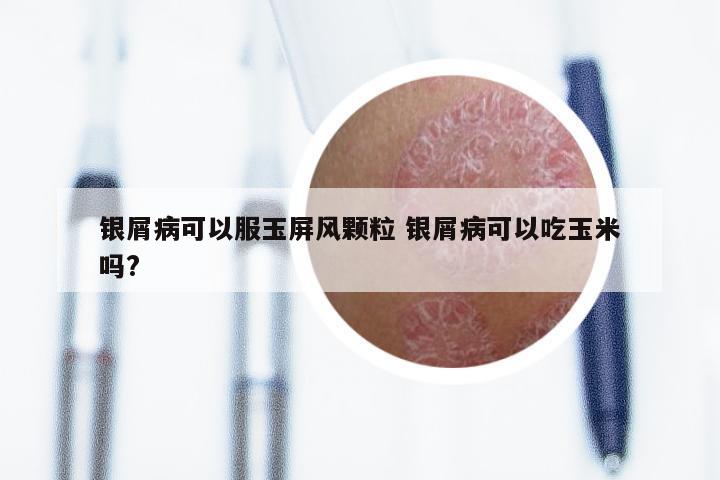 银屑病可以服玉屏风颗粒 银屑病可以吃玉米吗?