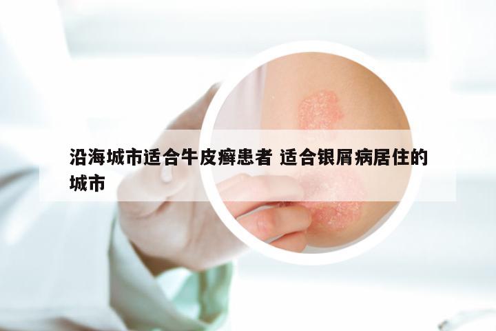 沿海城市适合牛皮癣患者 适合银屑病居住的城市