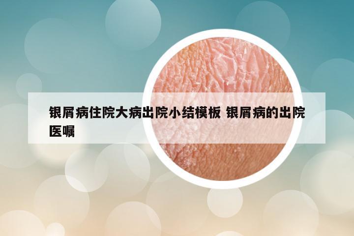 银屑病住院大病出院小结模板 银屑病的出院医嘱