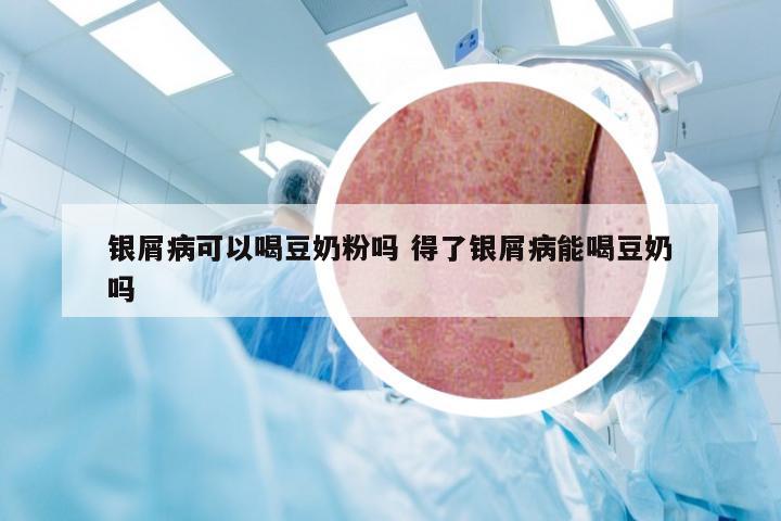 银屑病可以喝豆奶粉吗 得了银屑病能喝豆奶吗