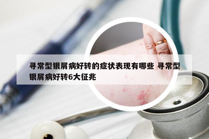 寻常型银屑病好转的症状表现有哪些 寻常型银屑病好转6大征兆