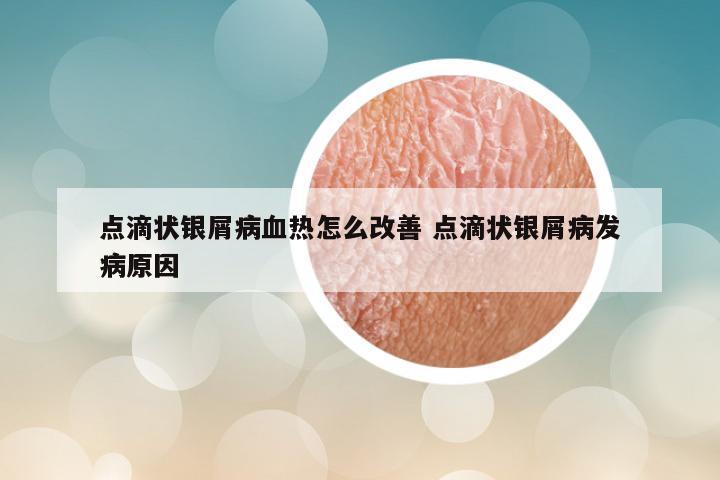 点滴状银屑病血热怎么改善 点滴状银屑病发病原因