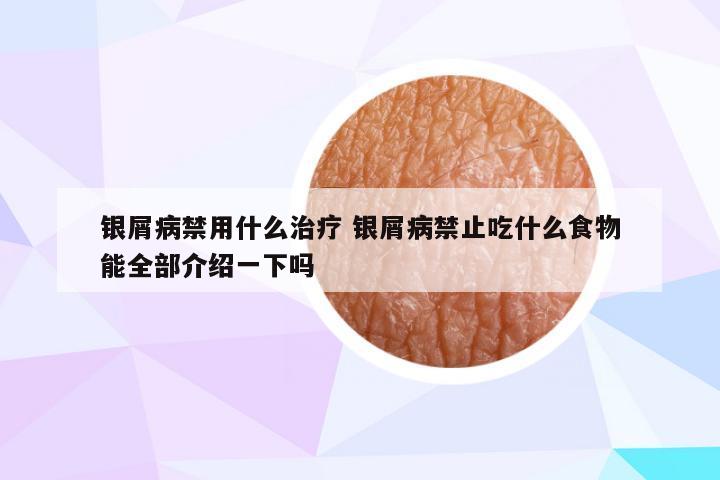 银屑病禁用什么治疗 银屑病禁止吃什么食物能全部介绍一下吗