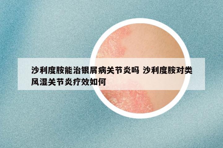 沙利度胺能治银屑病关节炎吗 沙利度胺对类风湿关节炎疗效如何