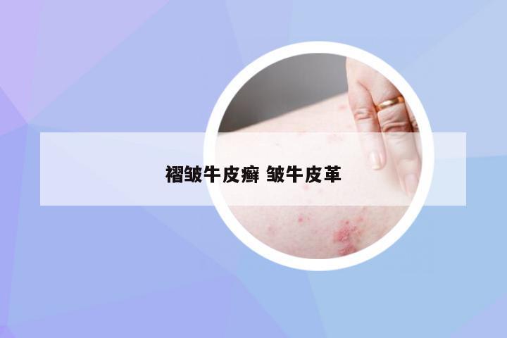 褶皱牛皮癣 皱牛皮革