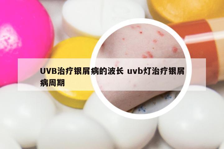 UVB治疗银屑病的波长 uvb灯治疗银屑病周期