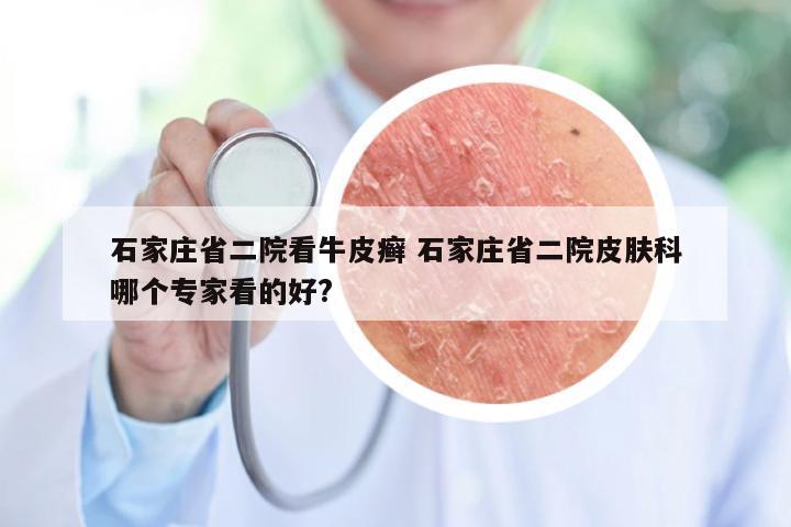 石家庄省二院看牛皮癣 石家庄省二院皮肤科哪个专家看的好?