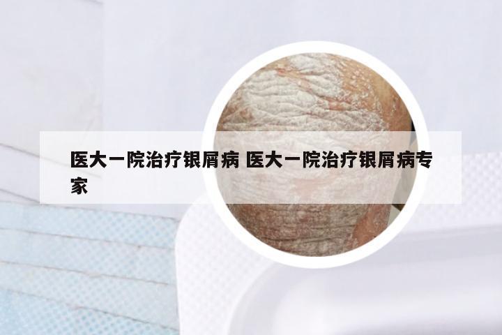 医大一院治疗银屑病 医大一院治疗银屑病专家