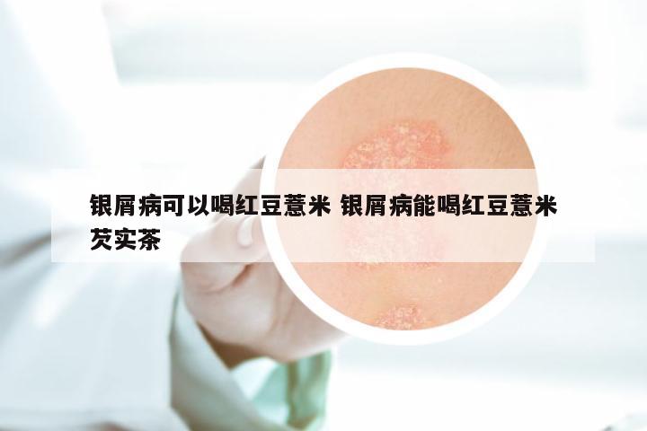 银屑病可以喝红豆薏米 银屑病能喝红豆薏米芡实茶
