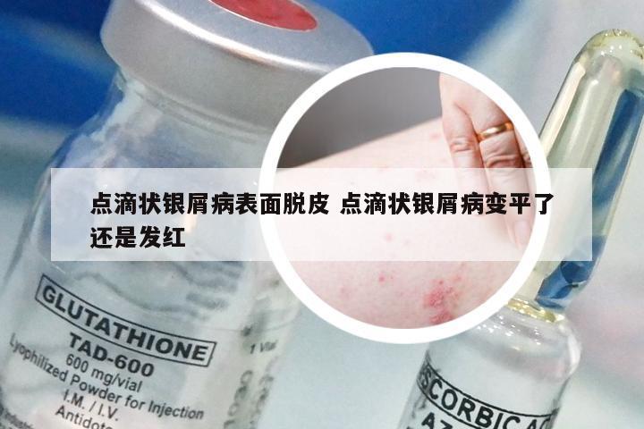 点滴状银屑病表面脱皮 点滴状银屑病变平了还是发红