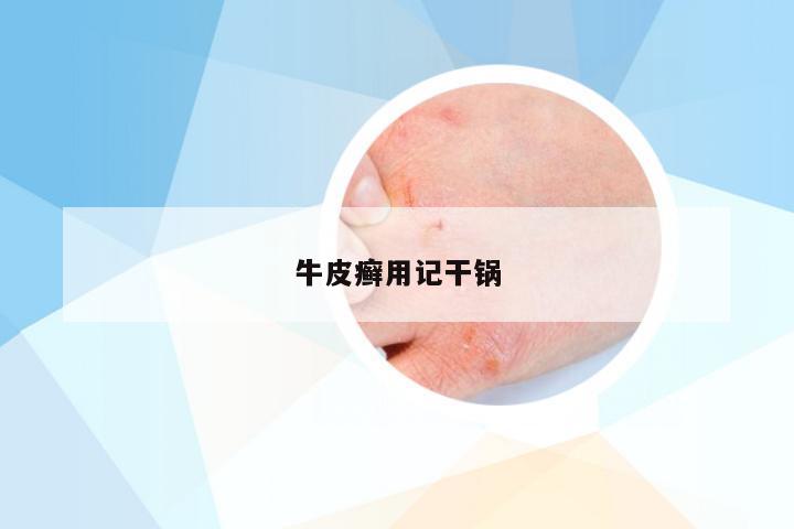 牛皮癣用记干锅