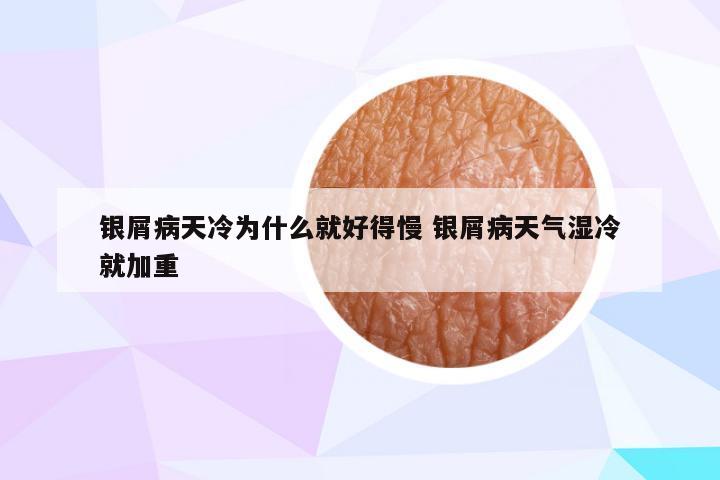银屑病天冷为什么就好得慢 银屑病天气湿冷就加重