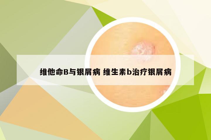 维他命B与银屑病 维生素b治疗银屑病
