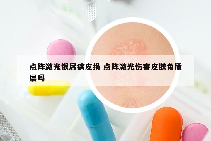 点阵激光银屑病皮损 点阵激光伤害皮肤角质层吗
