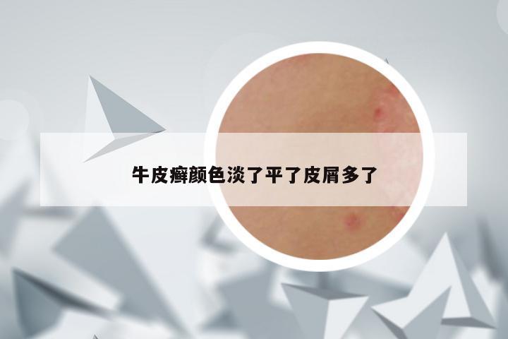 牛皮癣颜色淡了平了皮屑多了