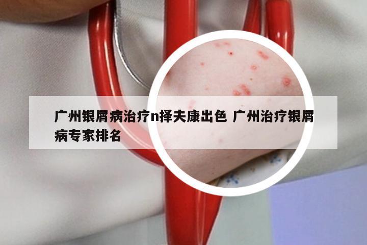广州银屑病治疗n择夫康出色 广州治疗银屑病专家排名