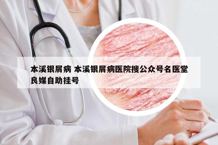 本溪银屑病 本溪银屑病医院搜公众号名医堂良媒自助挂号