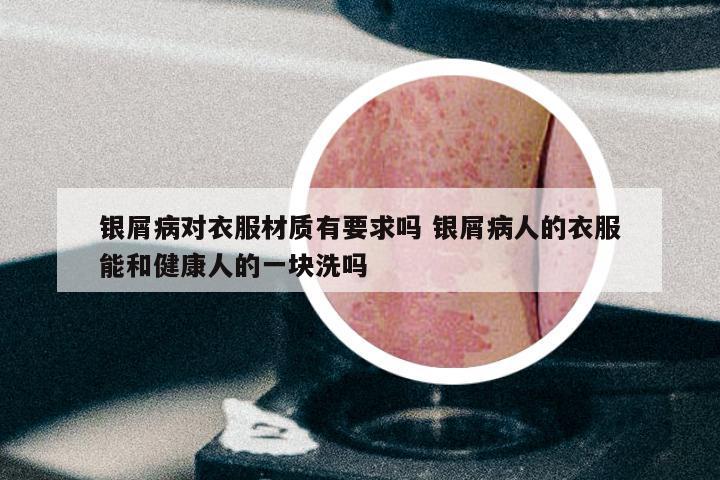银屑病对衣服材质有要求吗 银屑病人的衣服能和健康人的一块洗吗