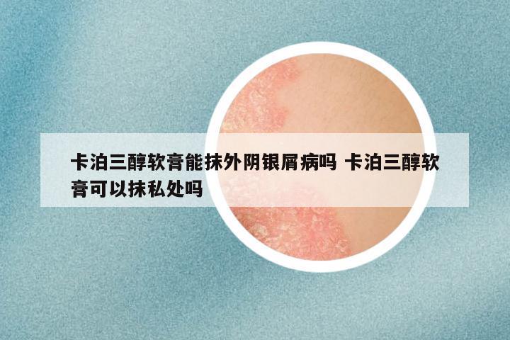 卡泊三醇软膏能抹外阴银屑病吗 卡泊三醇软膏可以抹私处吗