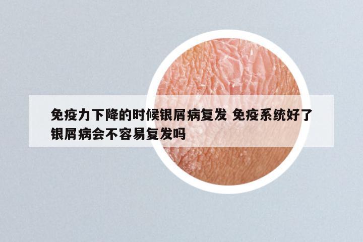 免疫力下降的时候银屑病复发 免疫系统好了银屑病会不容易复发吗
