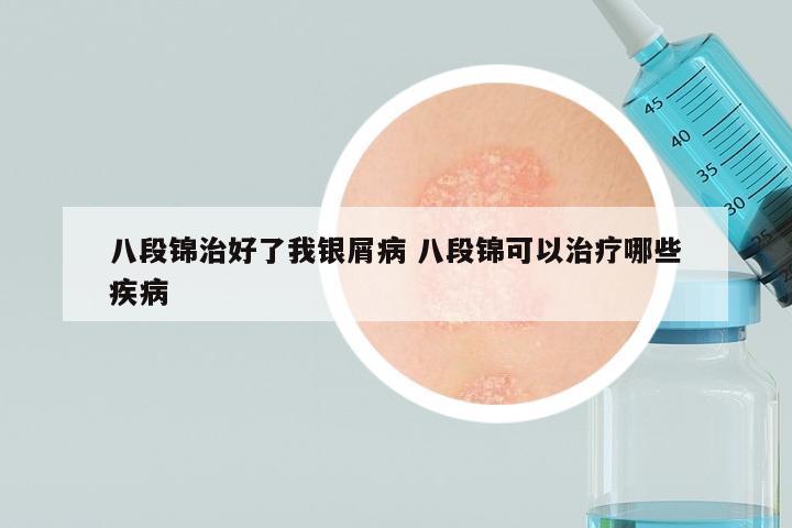 八段锦治好了我银屑病 八段锦可以治疗哪些疾病