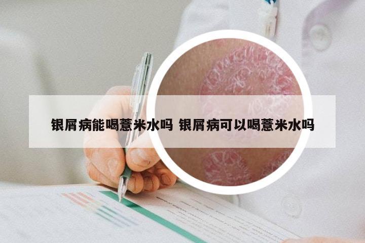 银屑病能喝薏米水吗 银屑病可以喝薏米水吗